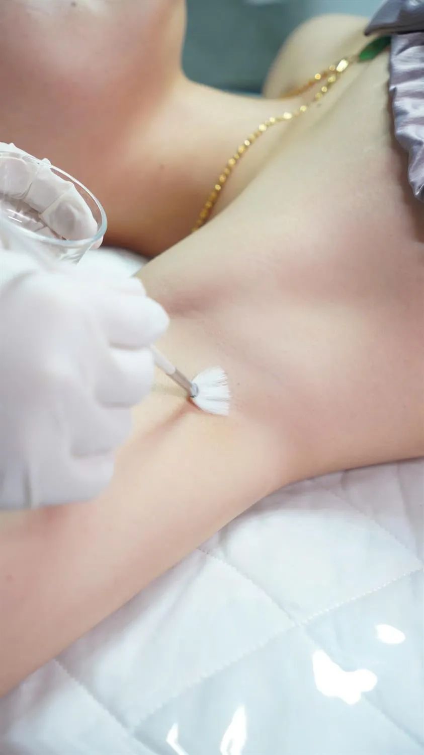 Delicate Zone Peel