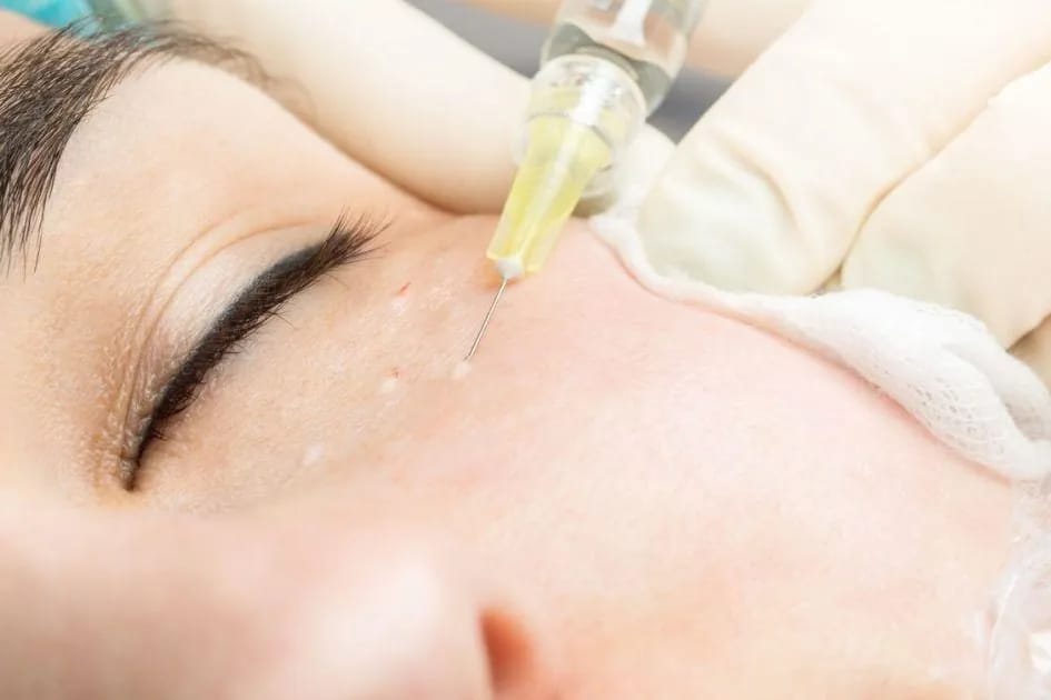 Rejuvenation Eye