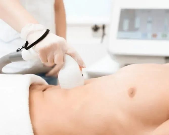 Triệt lông vùng ngực